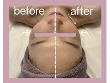 プルミエプラス 恵比寿店(PREMiER+)/【恵比寿/渋谷/小顔/たるみ】