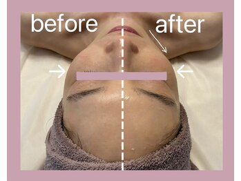 プルミエプラス 恵比寿店(PREMiER+)/【恵比寿/渋谷/小顔/たるみ】