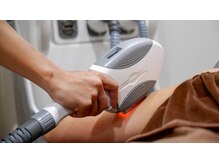 ミミ(Mimi)/大人気全身脱毛30分でツルスベ肌