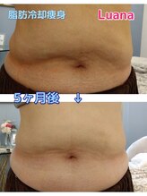 ルアナ(Luana)/ぽっこりお腹を夏までに無くす！