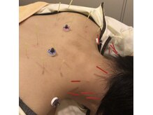 フィットジユウガオカ(Fit_Jiyugaoka)/30、40、50代のストレスケアに