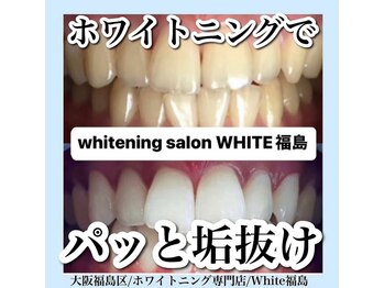 ホワイトニングサロン ホワイト(WHITE)/セルフホワイトニング/大阪/福島