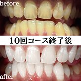 ホワイトニングショップ 浦和店