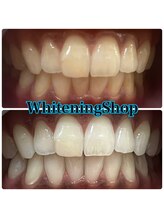 ホワイトニングショップ 山形店(Whiteningshop)/タバコOK