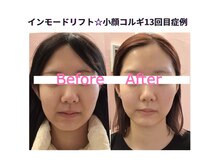 サロン ド シャーロット 恵比寿の雰囲気（韓国最新美容インモードリフト☆切らずに小顔＆リフトアップ↑）