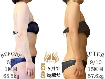 ビハーラ 門司店/5ヶ月で8kg痩身ダイエット|門司