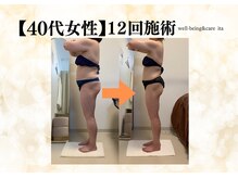 イタ 岡崎店(ita)/【　ビフォーアフター　】全身