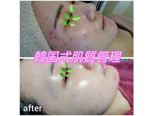 エタニティ(Eternity)の雰囲気（【専門機関レベル】本格プロ施術◆納得の効果お試し下さい）