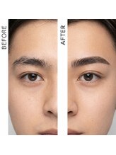 男性の清潔感アップをサポート！印象を変える目元へ◎