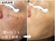 パールホワイトニングサロン 茅ヶ崎店の写真