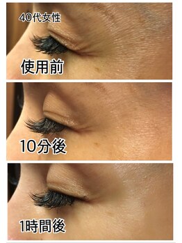 ラヴィエ ベル(La vie est belle)/REVI陶肌トリートメント