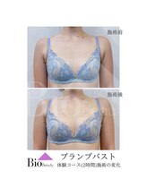 バイオビューティー 神戸本店(Bio Beauty)/プランプバスト　施術症例