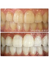 ホワイトニングルーム 横浜店(Whitening Room)/ホワイトニング/横浜