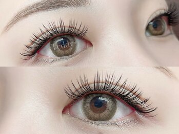 テディプラス(Teddy+)