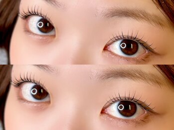 エムスリー つくば店(M3)/パッチリeye*