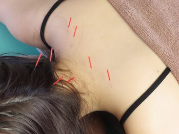 ハウオラ 三軒茶屋(HAUOLA)/施術【首肩こり/眼精疲労】