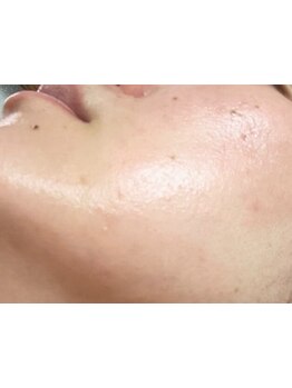 お肌をきれいにしたい