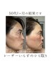 基本の草【初回体験★】￥8,800→￥8,250