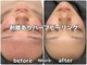 エヌハーブ(NHerb)の写真/《肌質改善をしたい方にもオススメ！》お客様の肌質やお悩み別に分けてご提案いたします◎