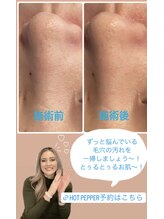 スムース(Smoooth)/before afterの写真撮影☆彡