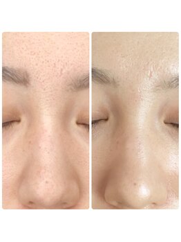 ル シェリア(Le Cherien)/【当店人気No.2メニュー】