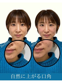 ハリラボ(hari Lab.)/【お客様の声】