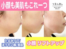 小顔/リフトアップ/たるみケアも最適なカウンセリングでご案内!!