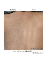 ルナ(Runa)/スノーピールのビフォーアフター