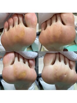 巻き爪補正店 町田店/