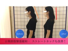 鍼灸院シマダ 宇多津(鍼灸院SHIMADA)の雰囲気(あなたの「痛みで出来ない事」を解決するための鍼灸院◎)