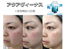 フェイシャルメニューやホームケア用品も充実してます！