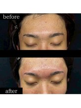 ユー 千葉駅前店(you)/メンズ眉毛/メンズ眉/千葉駅