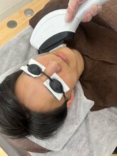 男前脱毛 鈴鹿店/ヒゲ脱毛の様子