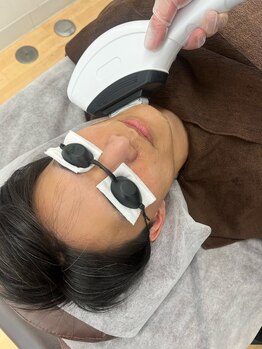 男前脱毛 鈴鹿店/ヒゲ脱毛の様子