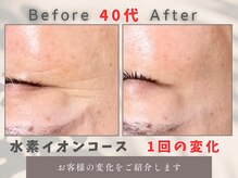 トータルビューティー雅