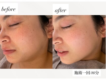 ピーロ ルレ(salon Piilo Rule)の写真