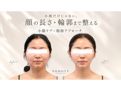 ポノティー(PONOTY)の写真