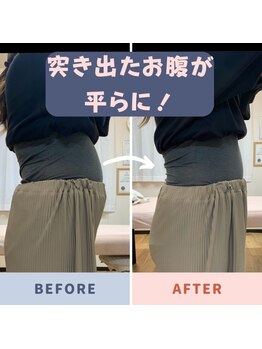 バンビ ビューティーラボ/反り腰改善で…