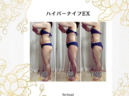 リヘッド(Re.head)の写真