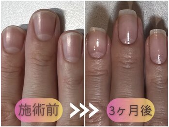 ケアリ(CAREri)/さらにキレイな爪を目指したい方