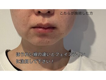 アジュール(azure)/リフトアップしました！