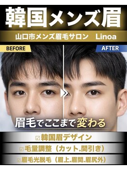 リノア(Linoa)/韓国メンズ眉毛デザイン脱毛