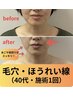 2回目以降　【小顔＆美顔】オール手技！韓国式小顔矯正パイテラピー