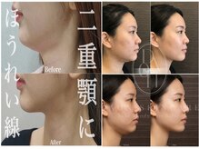多穏スキンケア(skin care)