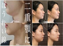 多穏スキンケア(skin care)
