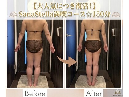 サーナステラ(Sana Stella)の写真
