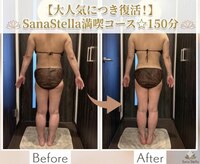 サーナステラ(Sana Stella)