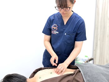 戸田みんなの鍼灸整骨院/上半身のつらい症状に◎