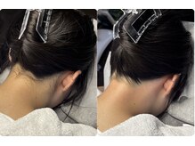 チョクチョクサロン(CHOKCHOK. Salon)の雰囲気（ワックス＆光のMIX脱毛！（ワックス脱毛/ブライダル））