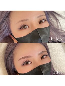 ダリ(Dali)/ハリウッドブロウリフト